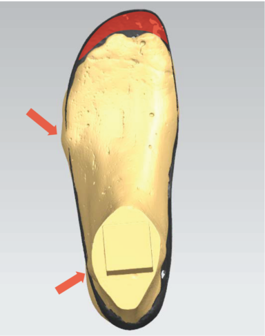 shoe-fit-connor-384x488